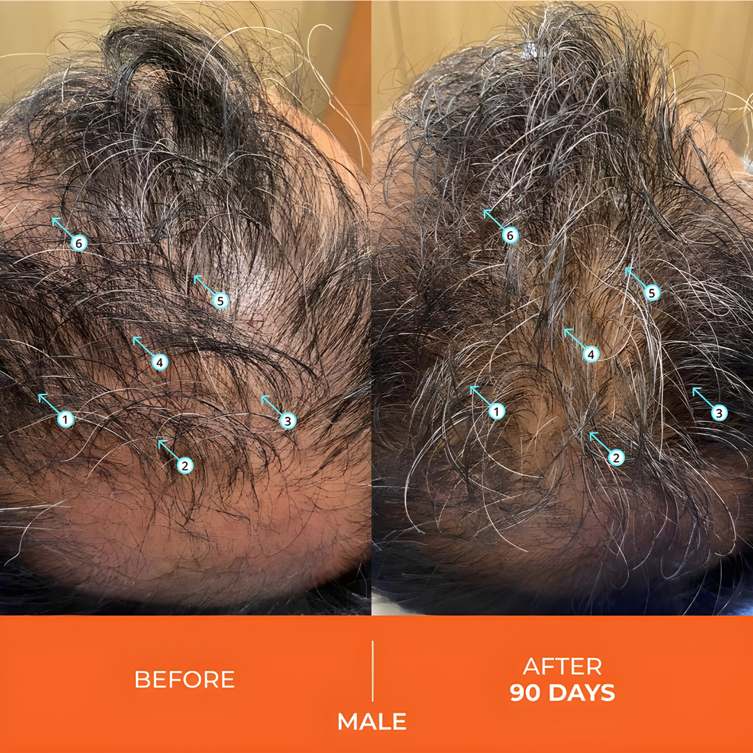 Shampoo For Thinning Hair