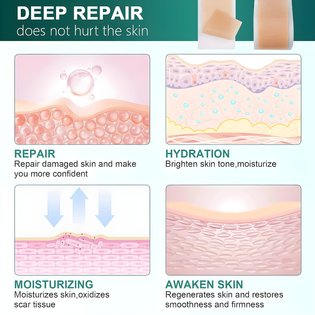 Silicone Scar Sheets