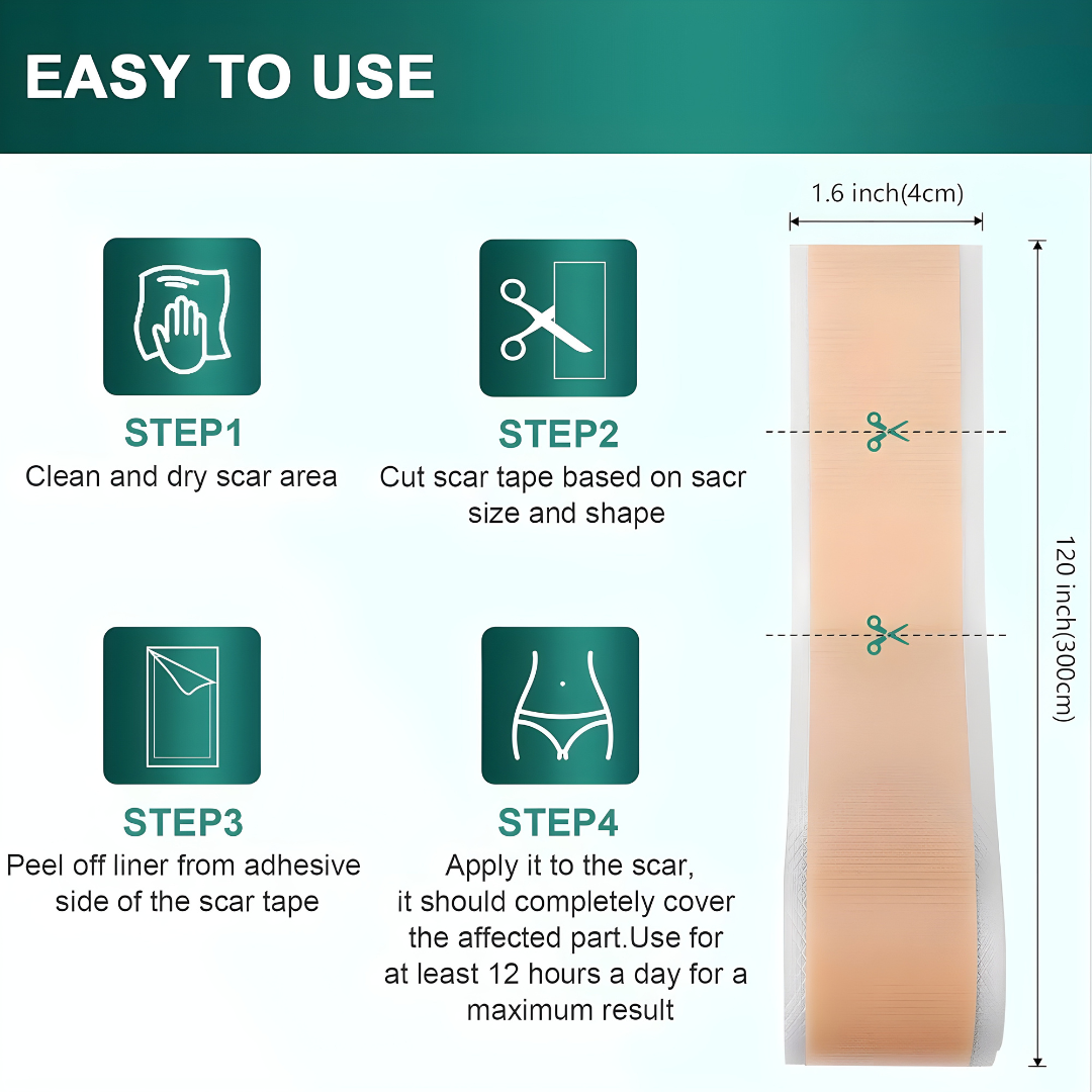 Silicone Scar Sheets