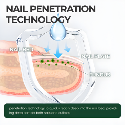 Nail Repair
